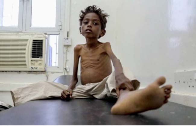 سازمان ملل:  ۲۰ میلیون انسان را گرسنگی تهدید می کند
